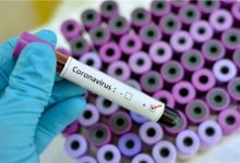 Photo of Anvisa aprova três novos testes para coronavírus