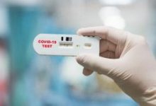 Photo of Anvisa libera realização de testes para detecção de coronavírus em farmácias