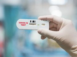 Photo of Anvisa libera realização de testes para detecção de coronavírus em farmácias