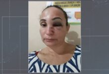 Photo of Mulher agredida e ameaçada pelo ex-marido em Igaracy pede socorro em vídeo