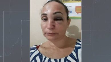 Photo of Mulher agredida e ameaçada pelo ex-marido em Igaracy pede socorro em vídeo