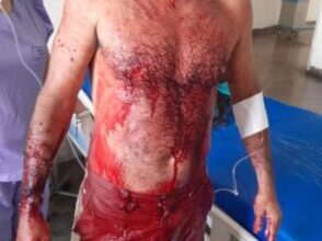 Photo of Homem fica ferido após agressão em Piancó