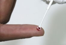 Photo of Saúde disponibiliza teste rápido de HIV em Patos, no Sertão