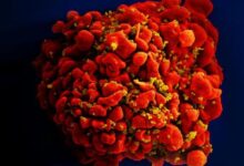 Photo of Cientistas anunciam novo caso de remissão do HIV após transplante de medula óssea