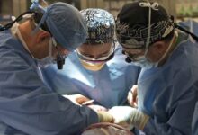 Photo of Médicos fazem transplante de coração de porco em paciente nos EUA