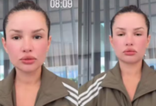 Photo of Juliette surge com rosto inchado após tratamento com ‘esperma de salmão’