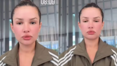 Photo of Juliette surge com rosto inchado após tratamento com ‘esperma de salmão’