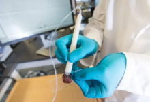 Photo of Pesquisadora brasileira cria caneta que detecta câncer em 10 segundos