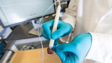 Photo of Pesquisadora brasileira cria caneta que detecta câncer em 10 segundos